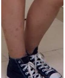 CONVERSE ALL STAR | スニーカー