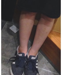 adidas | スニーカー