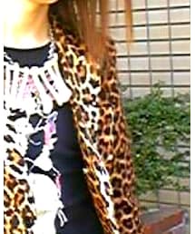 SEXY DYNAMITE LONDON | ジャケット/アウター