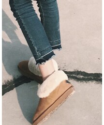 UGG | アクセサリー