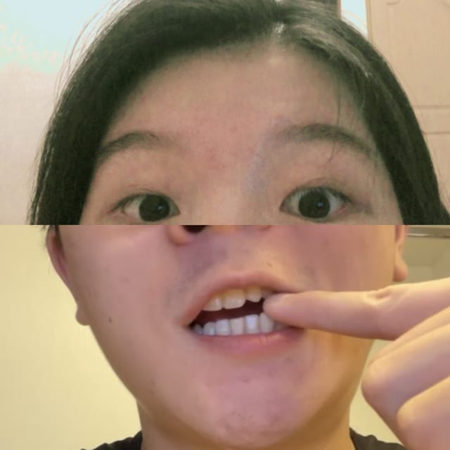 修！