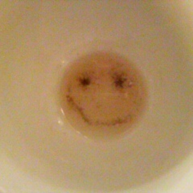 あこ
