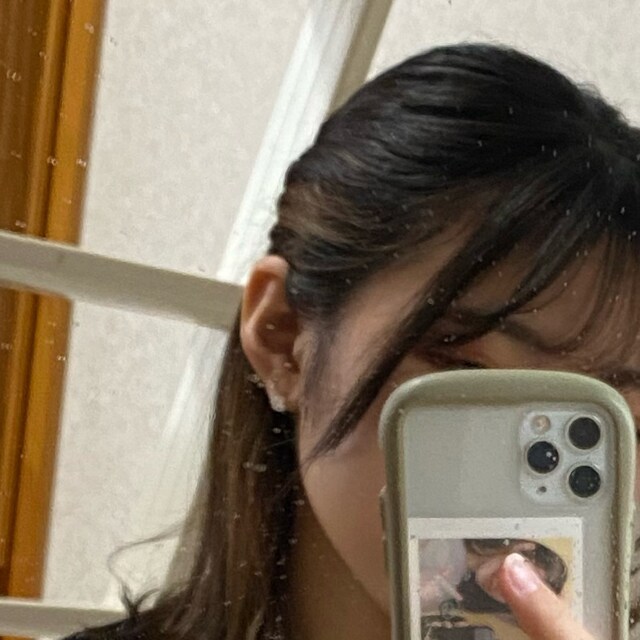 ちょん