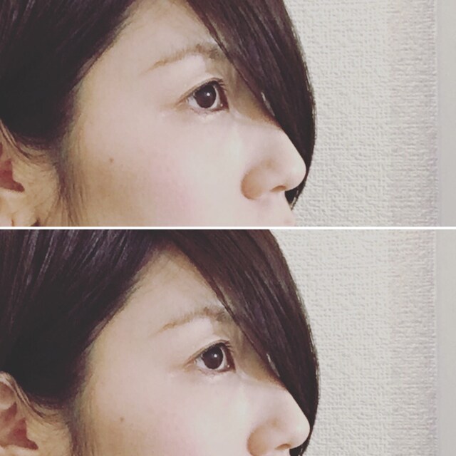 kimi